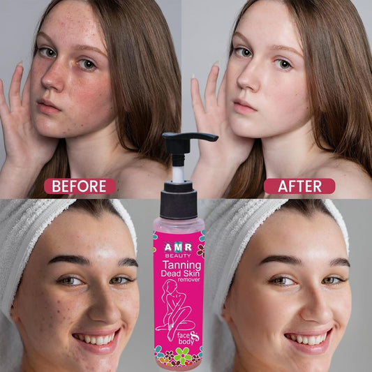 Tan & Dead Skin Removal Gel Spray